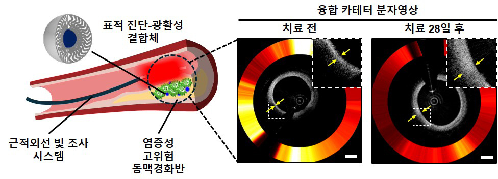 그림1