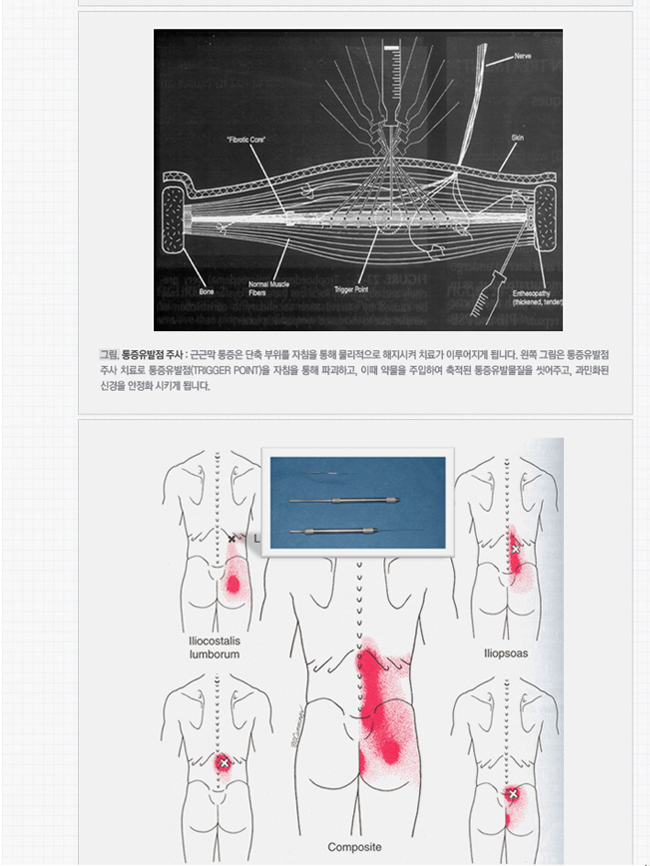 마취통증의학과