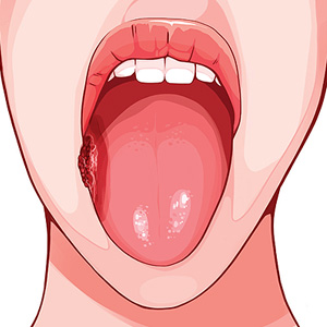 ���� ����